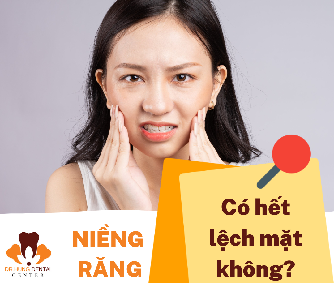 Lệch mặt