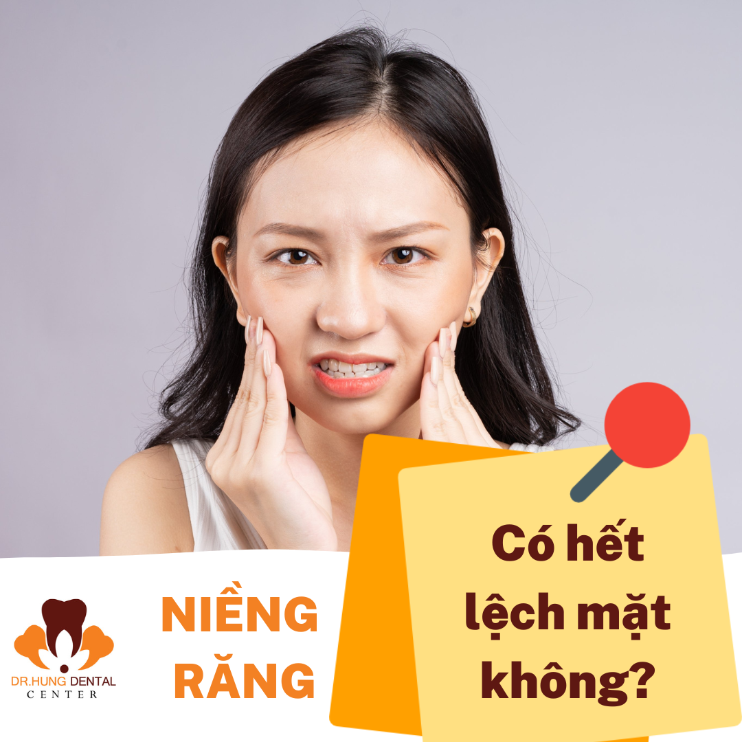 niềng răng có hết lệch mặt không