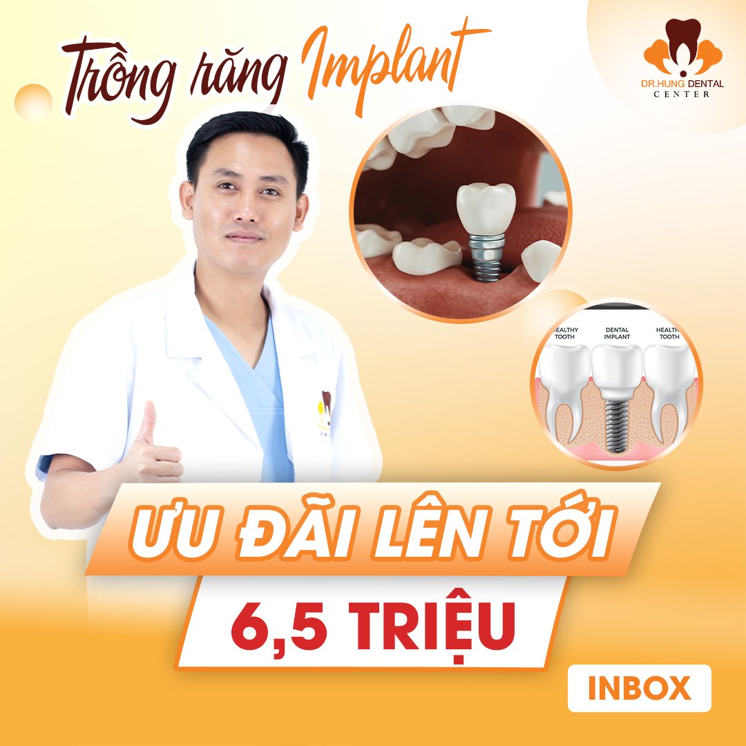 Trồng răng Implant không đau