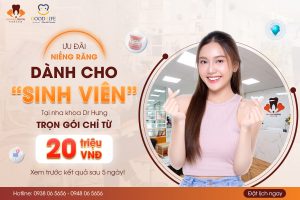 Ưu Đãi Niềng Răng Sinh Viên