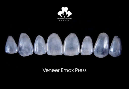 Dán sứ veneer Emax Press