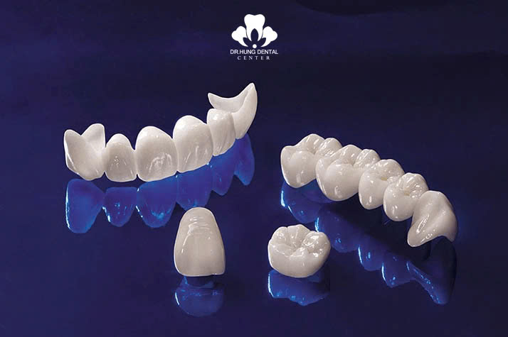 Răng sứ Ceramil