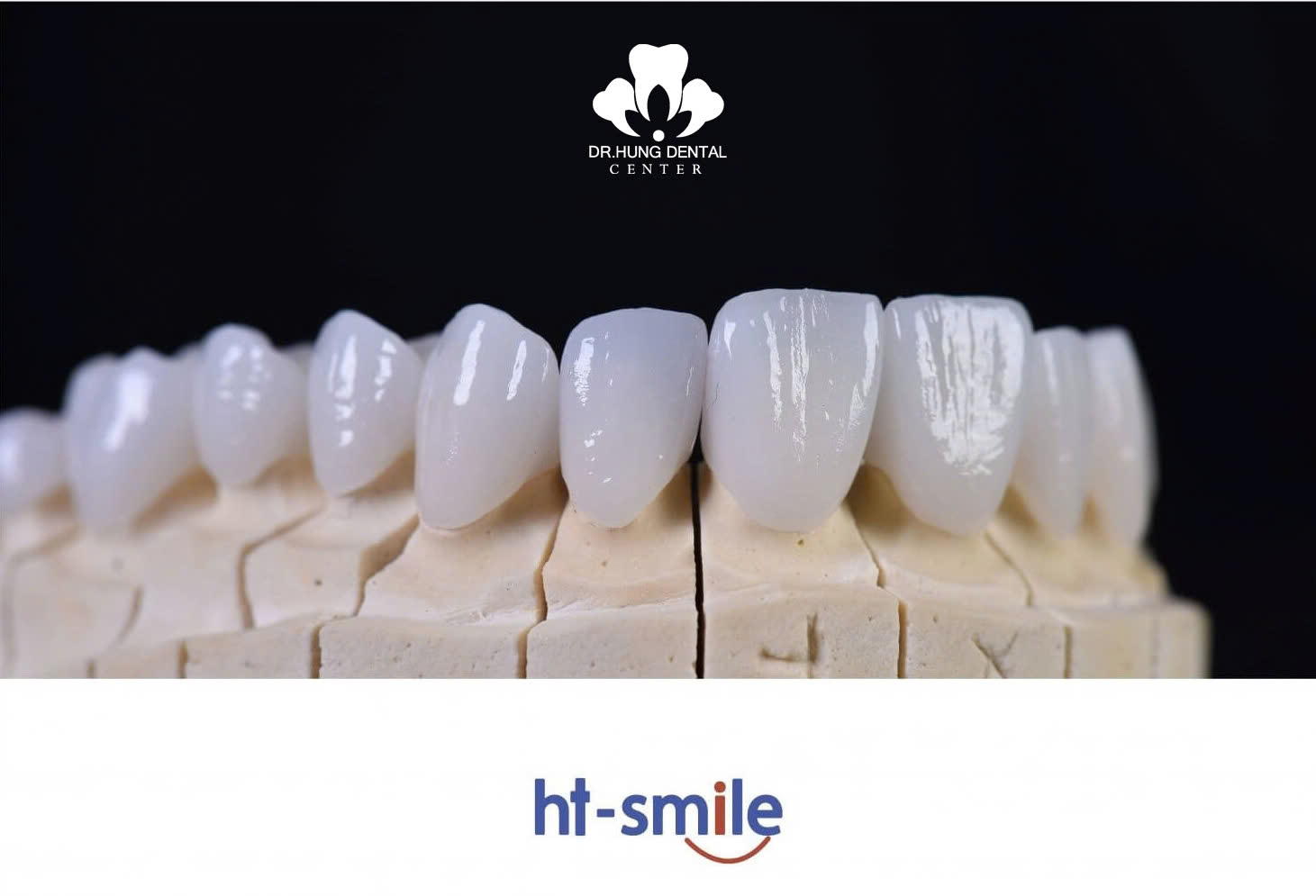 Răng sứ HT Smile