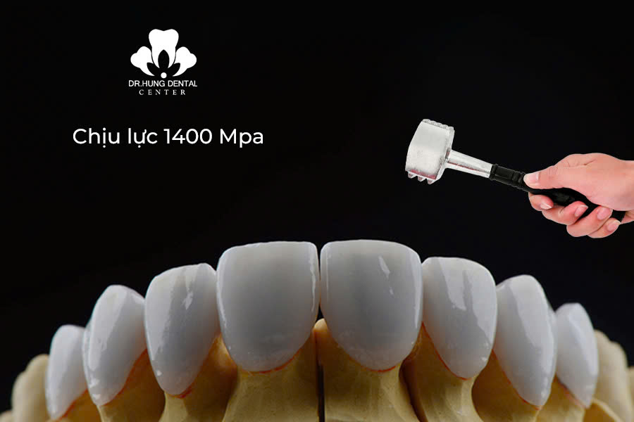 Răng sứ HT Smile