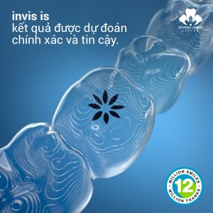 Niềng Răng Trẻ Em Bằng Invisalign