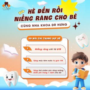Niềng răng cho bé