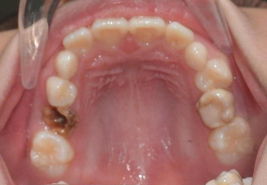 Phòng Khám Nha Khoa Tại Gia Lâm