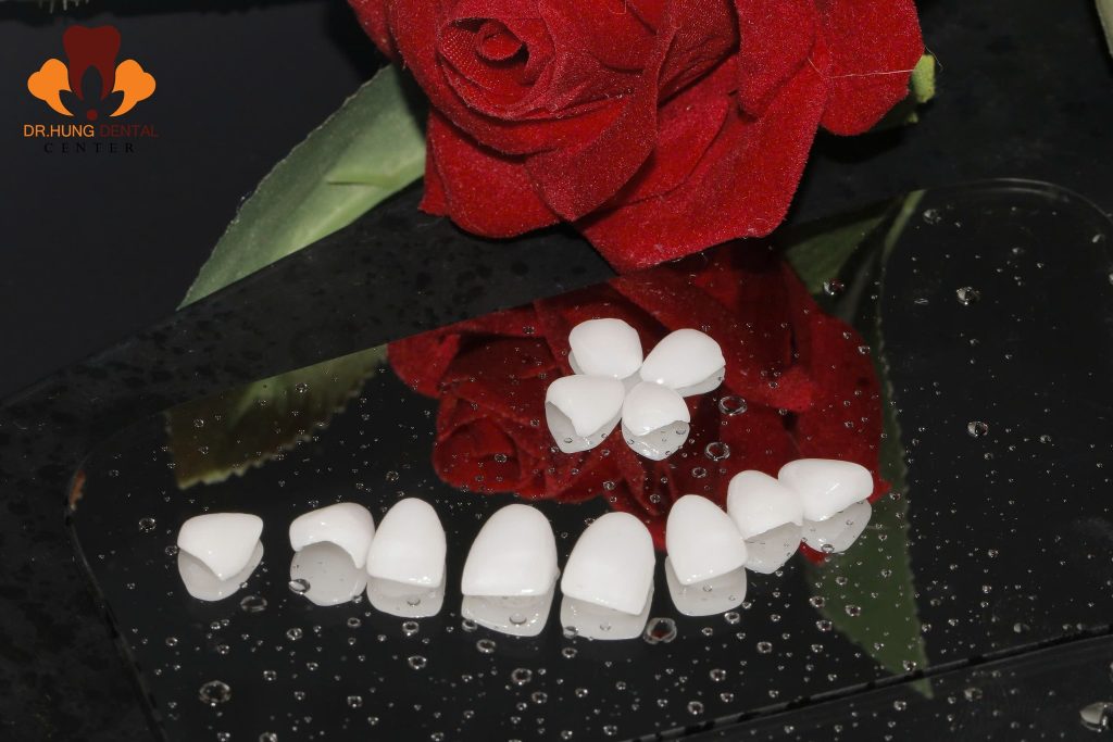 làm răng sứ Gia Lâm