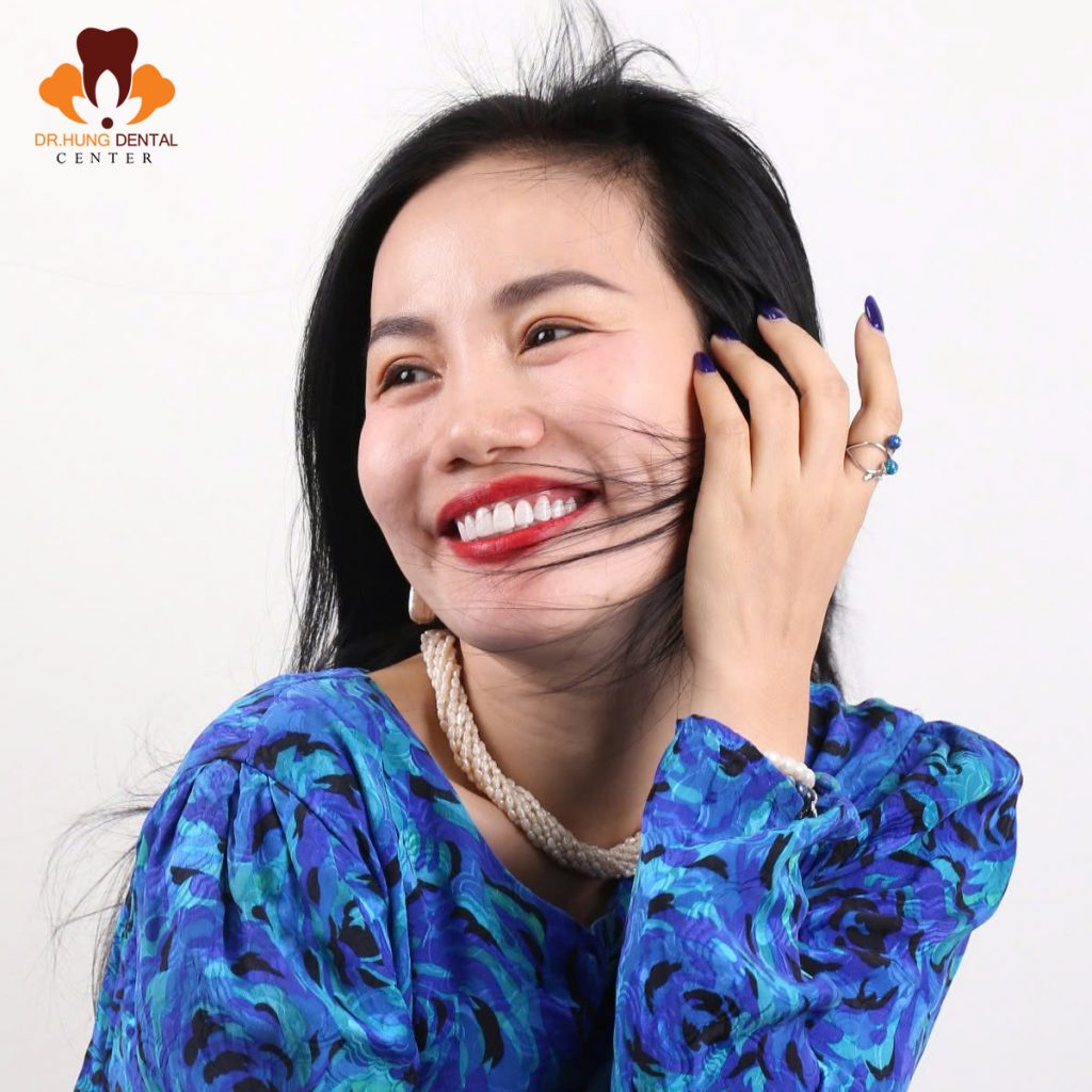 làm răng sứ Gia Lâm