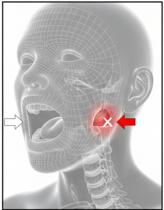 Khớp thái dương hàm