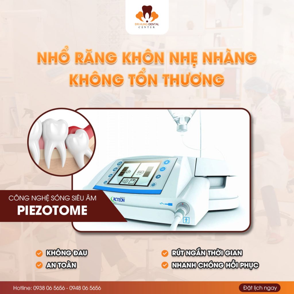 Nhổ răng khôn tại gia lâm