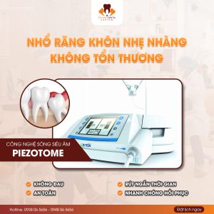 Nhổ răng khôn tại gia lâm