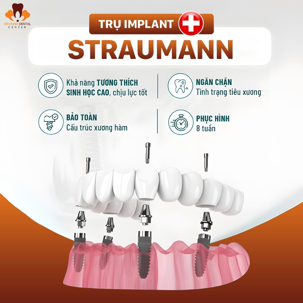 cấy ghép implant tại gia lâm
