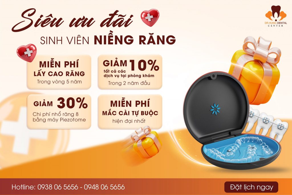 niềng răng sinh viên tại Gia Lâm