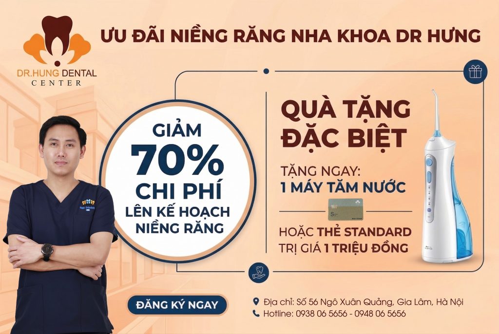 niềng răng sinh viên tại Gia Lâm