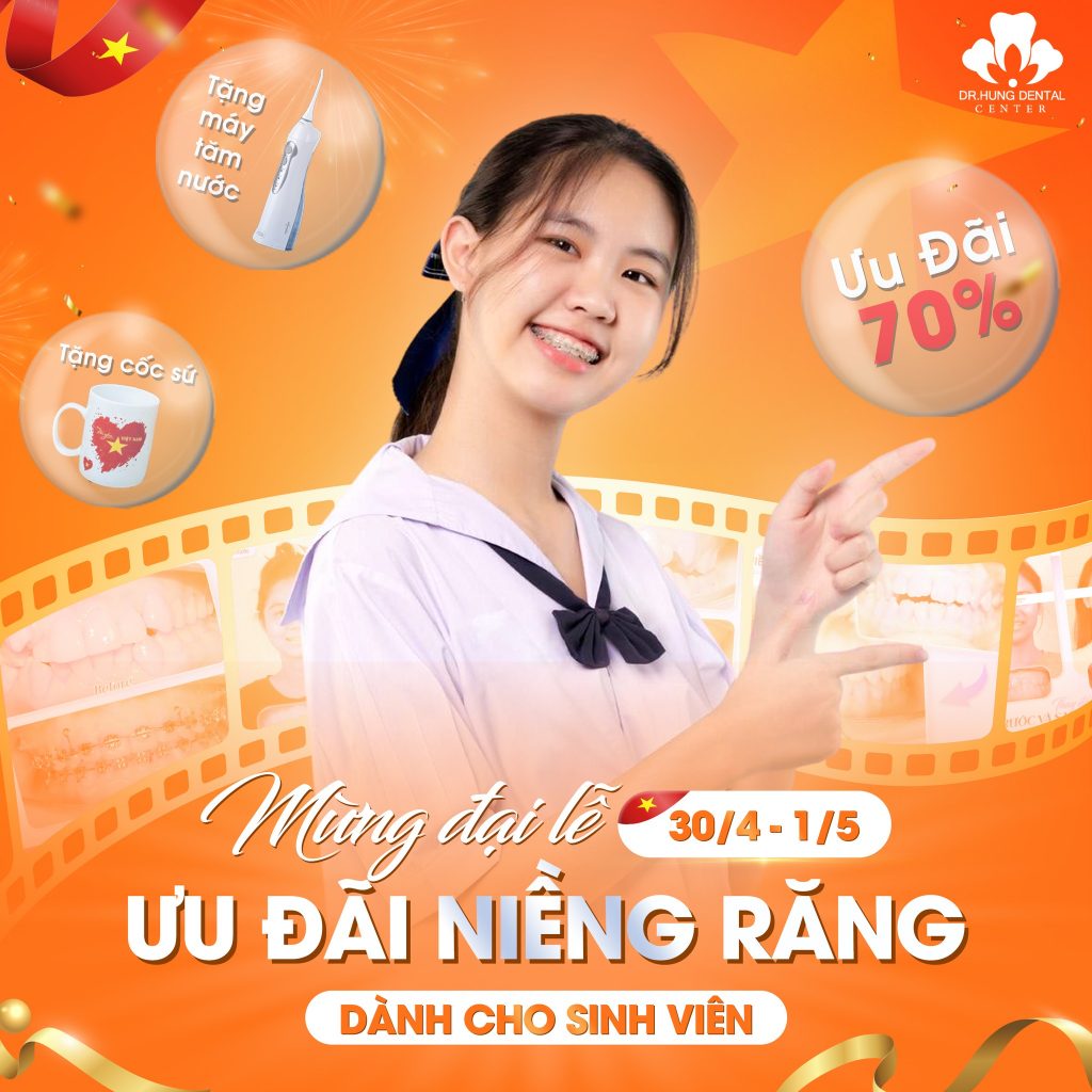 niềng răng sinh viên