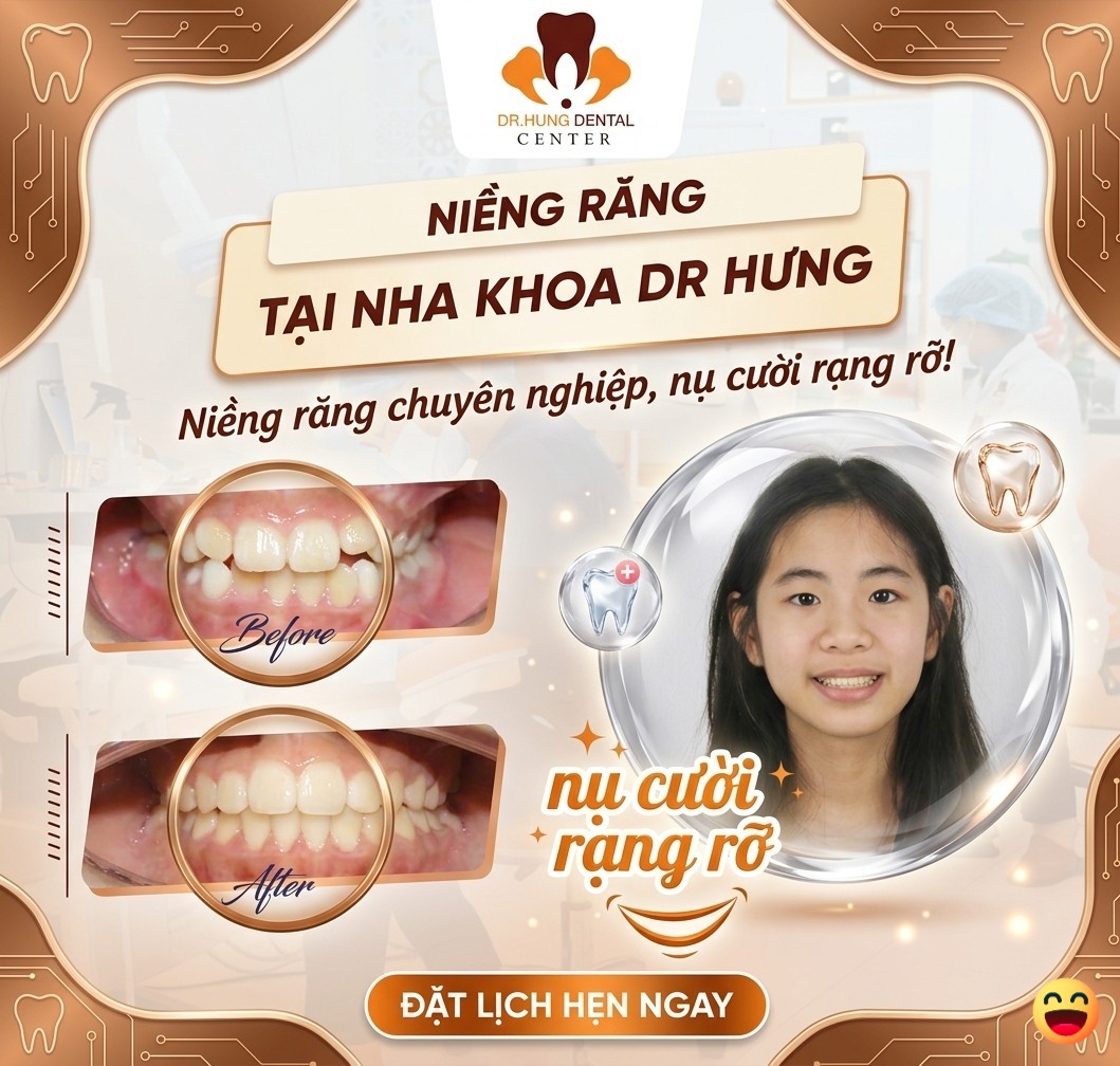 Niềng răng cho con