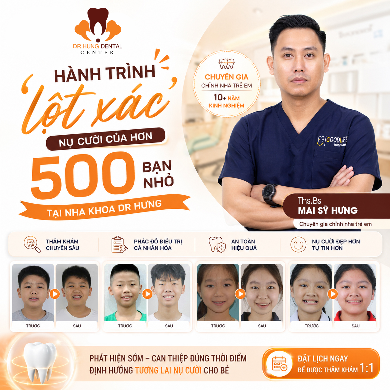 Niềng răng cho trẻ