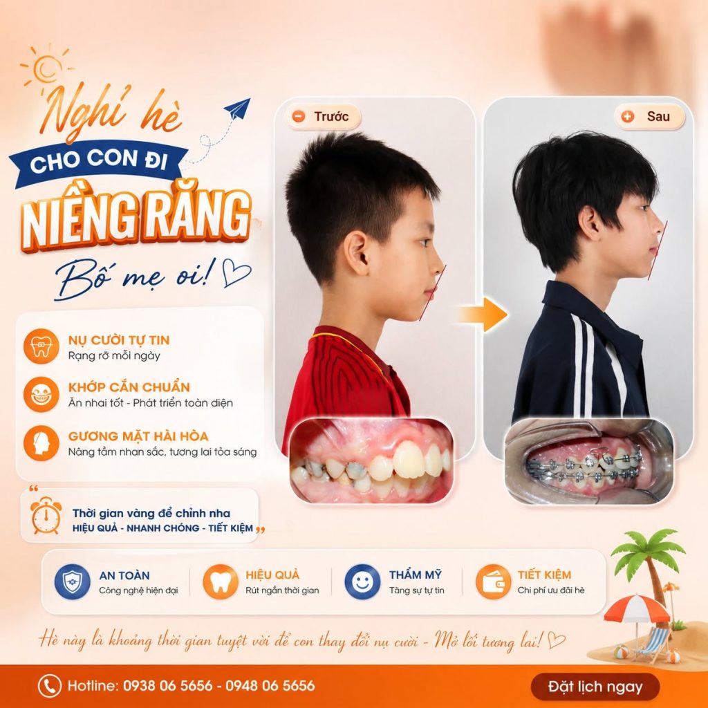 niềng răng trẻ em tại gia lâm