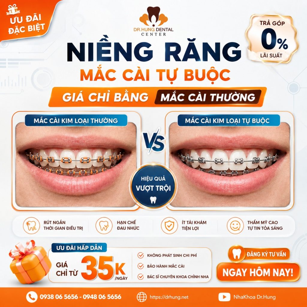 ưu đãi niềng răng