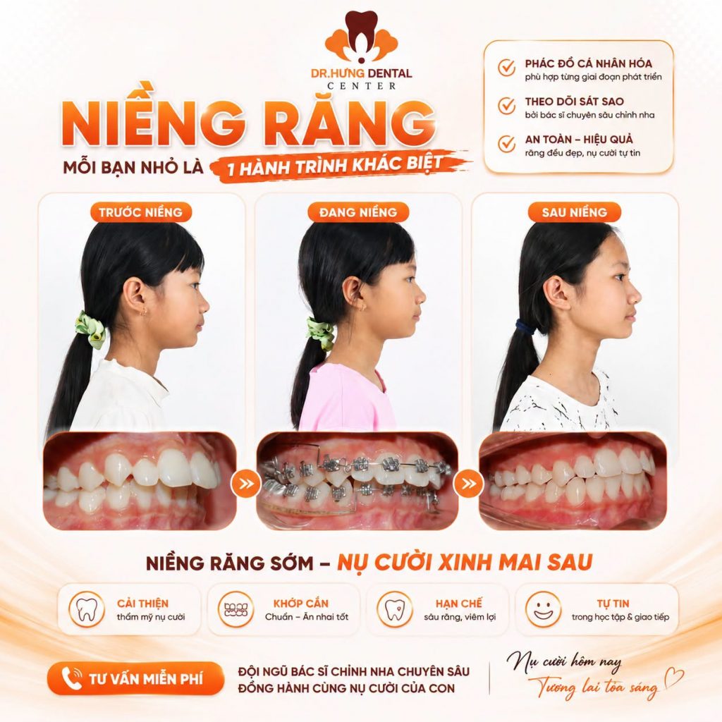 bé hô nhẹ có cần niềng không