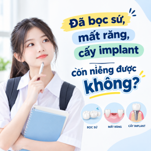 niềng răng khi mất răng