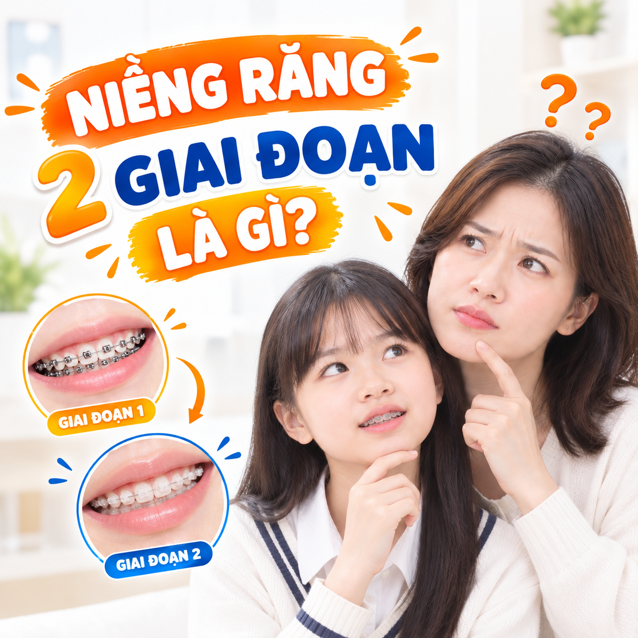 Niềng răng 2 giai đoạn